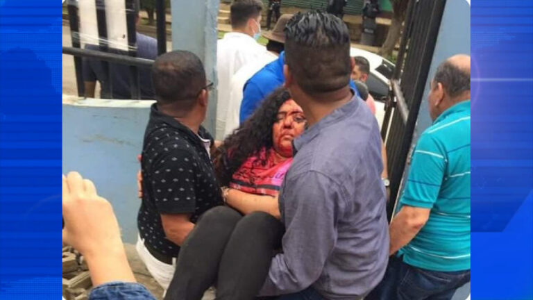 Periodista Verónica Chávez continua en Cuidados Intensivos