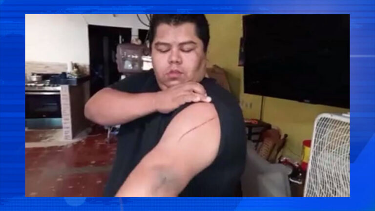 La madre de Nelson no tuvo conocimiento de la agresión sufrida a manos de la policía