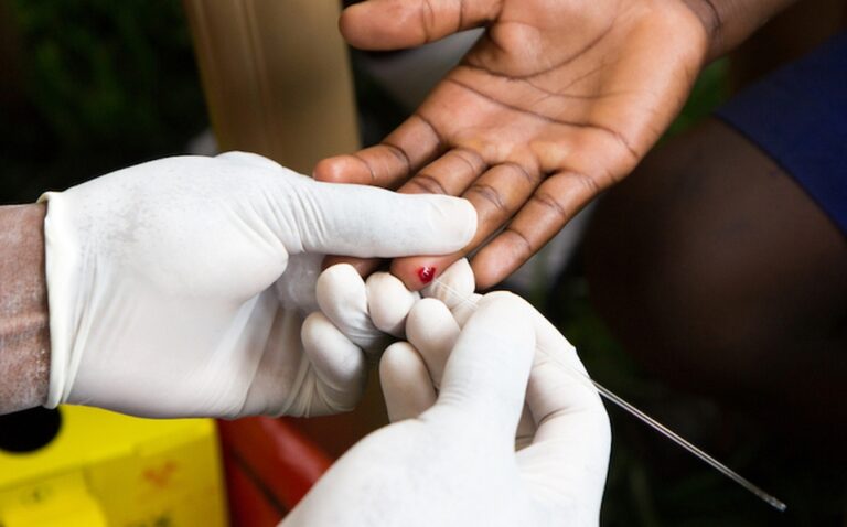 340 personas fueron identificadas con el virus del VIH
