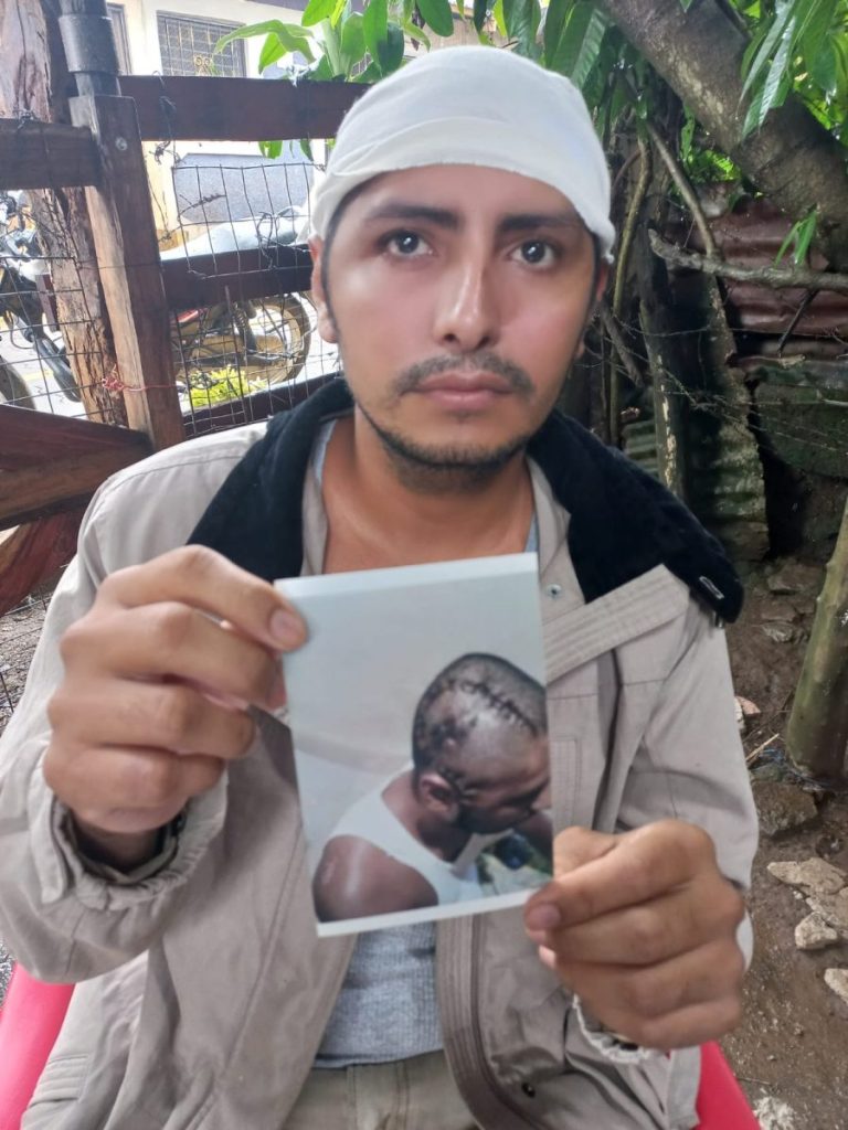 José Leonel Silva Espinoza victima de accidente de transito en carazo 2