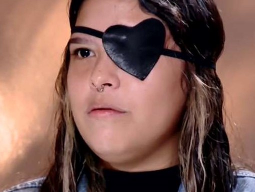 Aymará Davis perdio su ojo cuando la empujaron contra su pastel de cumpleaños y se le insertara un pincho