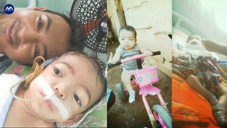 familia solicita ayuda para salvar la vida a niño con rara enfermedad Foto Nicaragua Actual