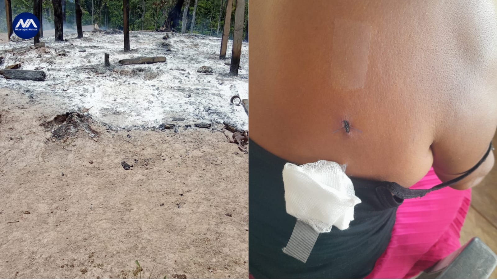 Dos casas incendiadas y una personas herida es el resultado de invasión de colonos en comunidad Mayangna.