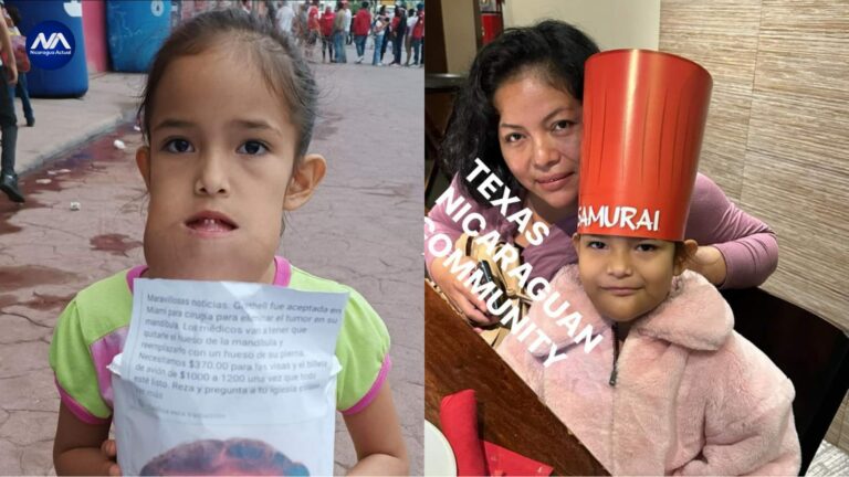 Grethel es la niña esteliana diagnosticada con un tumor en la mandíbula y sometida a una operación en Miami. Foto: NA.